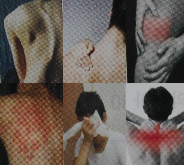 원요양병원통증치료클리닉